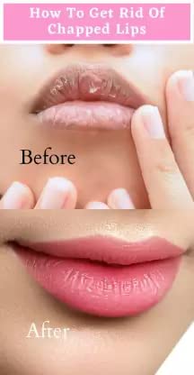 Aloe Vera Soothing Gel Lip Balm - Hydrating & Moisturizing Lip Care for Dry, Chapped Lips - Perfect for Winter, Outdoor Activities & Daily Use