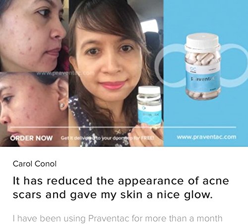 Natural Acne Treatment Supplement - Reduce Pimples, Blemishes & Scars for Clear Skin | Face & Body Acne Relief | 60 Capsules | Safe & Effective for Oily Skin | Perfect for Daily Skincare Routine & Travel