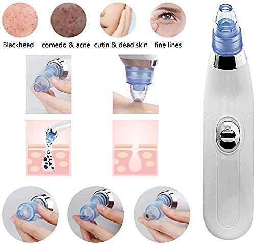 SunHeart Hubs Professional Acne Pore Cleaner Vacuum - Blackhead & Pimple Remover Kit for Face Care - Blue & White Skin Care Tool - Perfect for Daily Cleansing & Spa Treatments