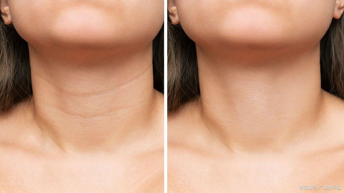 Best Neck Lift & Firming Cream for Sagging Skin - Anti-Aging Tightening Treatment for Neck & Décolleté - Perfect for Daily Skincare Routine & Nighttime Use