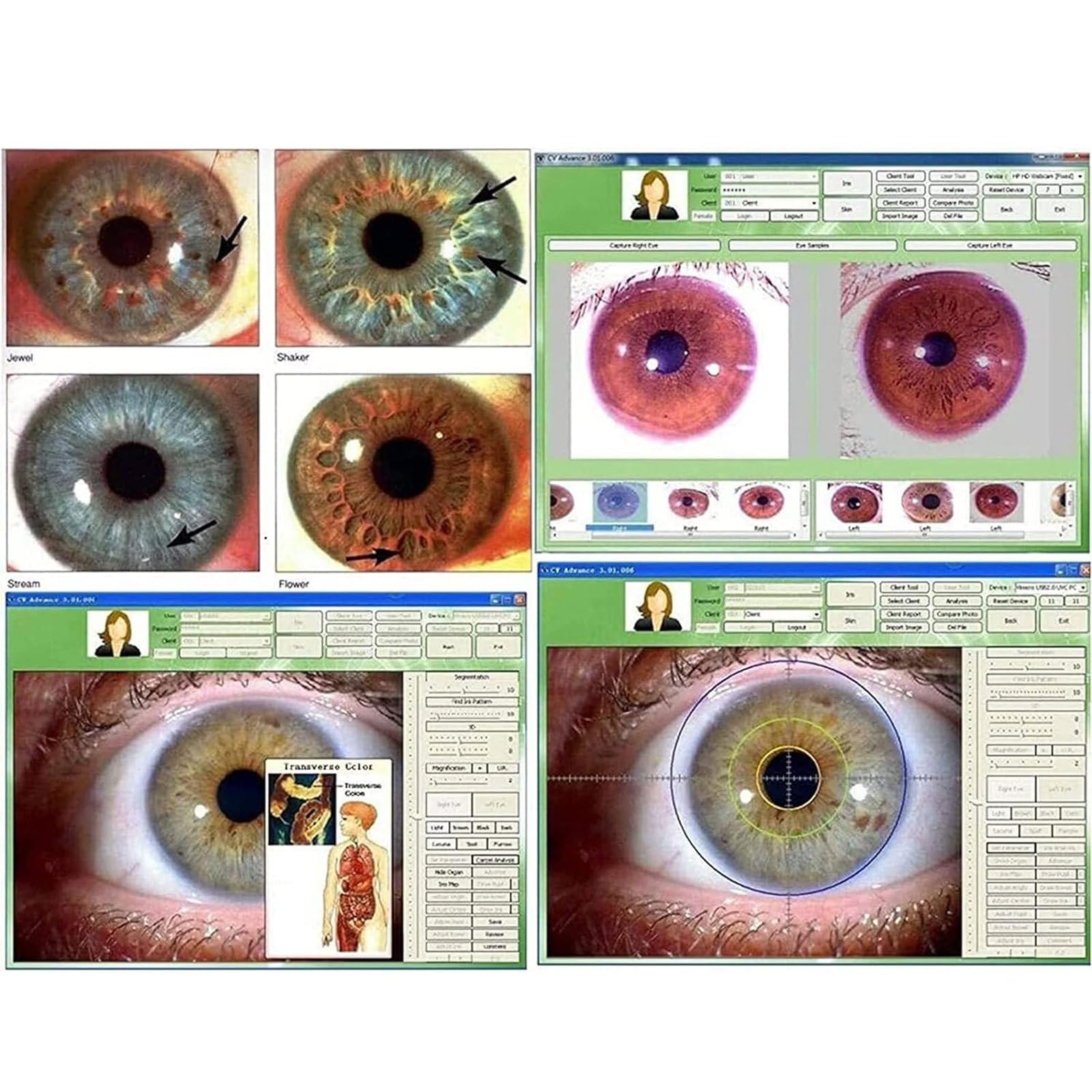 LSHFYV 5.0MP USB Iridology Camera with 30X Iris Lens & Analysis Software - Professional Iris Analyzer for Eye Health Diagnosis - Perfect for Naturopaths, Holistic Practitioners and Alternative Medicine Clinics
