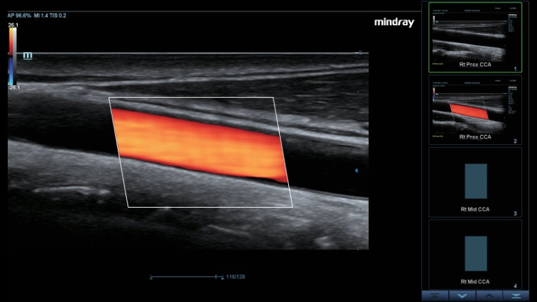 Mindray DC-70 Full HD Ultrasound System - Professional Diagnostic Imaging for Hospitals, Clinics & Veterinary Use