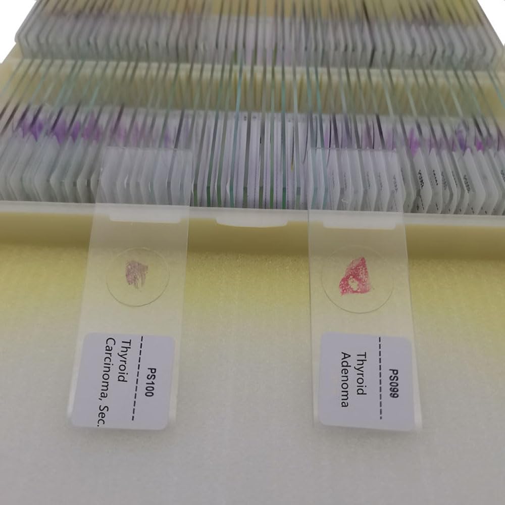 100pcs Human Pathological Tissue Specimen Slides - Prepared Microscope Slides for Medical Education & Research | Ideal for Lab Studies, Histology Classes & Disease Diagnosis