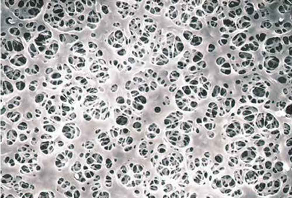 Y100A142A 142mm Cellulose Acetate Membrane Filters - 0.45 Micron Pore Size, Sterile Lab Filters (Pack of 100) - Ideal for Water Testing, Air Monitoring & Laboratory Sample Preparation