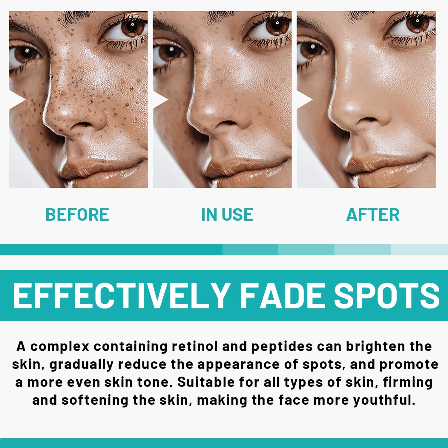 2PCS Dark Spot Remover Serum for Face - Advanced Formula with Niacinamide & Retinol for Sun Spots, Age Spots, Acne Scars, Melasma - Brightening Treatment for Women and Men - Perfect for Daily Skincare Routine & Hyperpigmentation Correction