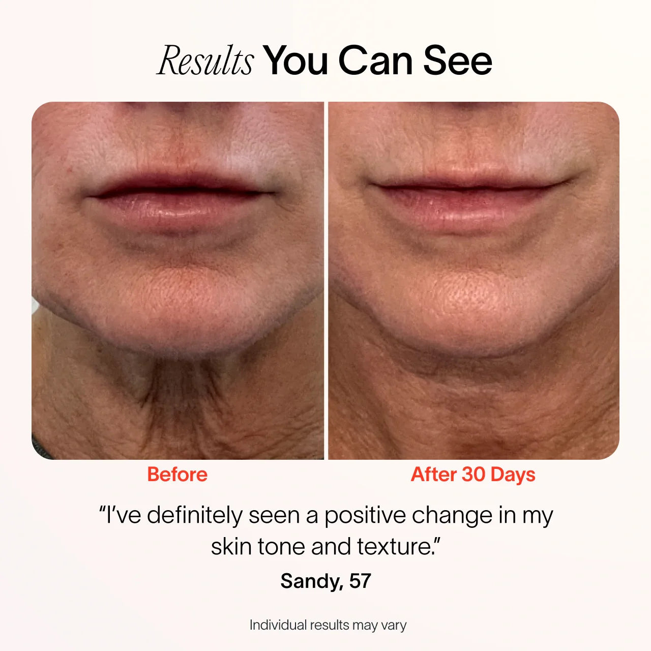 4 in 1 Radiant Renewal Skincare Wand with Red Light Therapy - Anti-Aging, Wrinkle Reduction, Skin Tightening & Brightening | At-Home Facial Device for Glowing Skin | Perfect for Daily Skincare Routine & Spa Nights