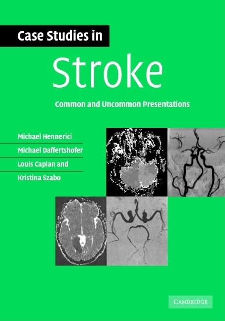 Stroke Case Studies: Common and Uncommon Presentations in Neurology - Clinical Scenarios for Medical Professionals