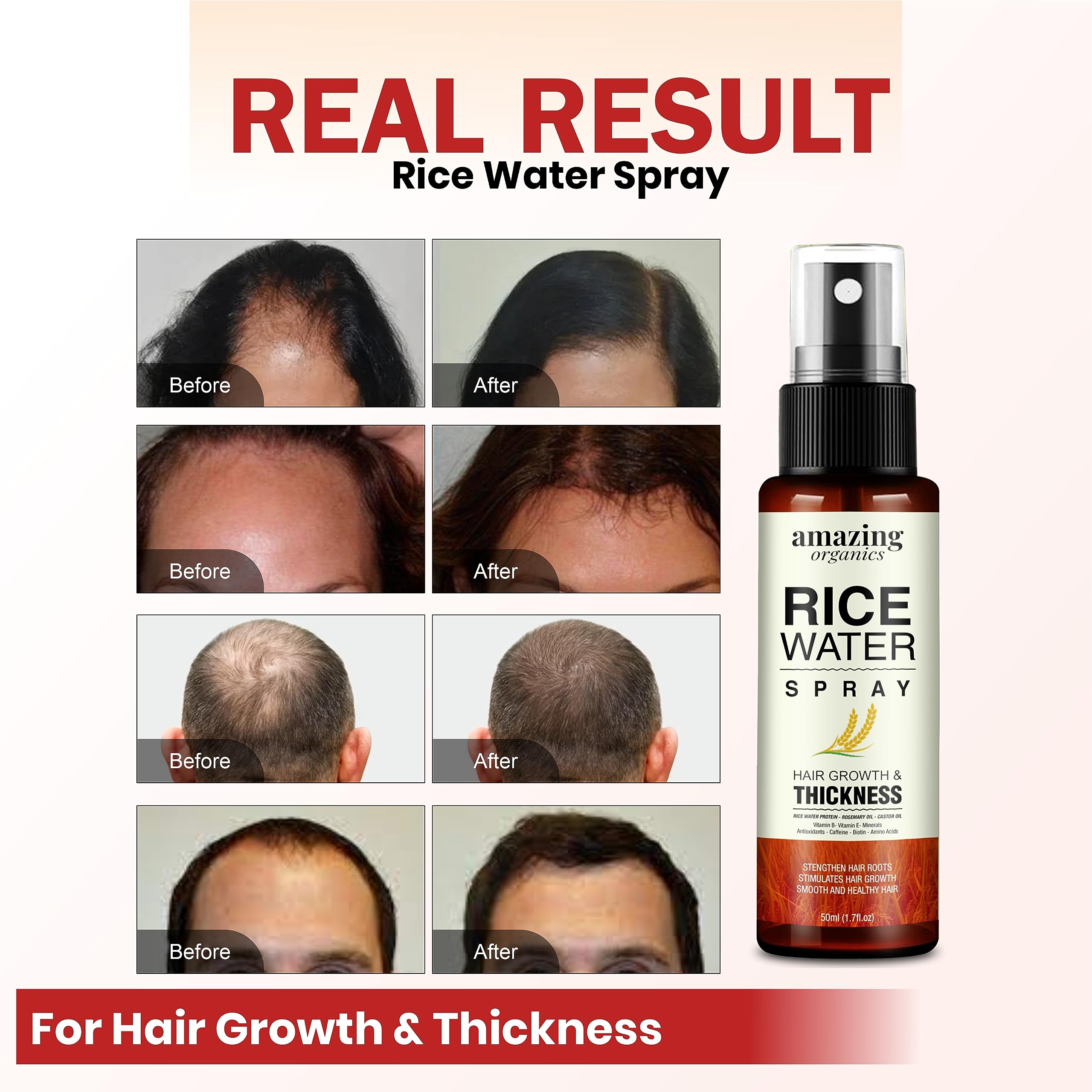 Rice Water Hair Growth Spray with Rosemary & Castor Oil - Natural Hair Loss Treatment for Women & Men - Promotes Thicker, Stronger Hair for Daily Care & Styling
