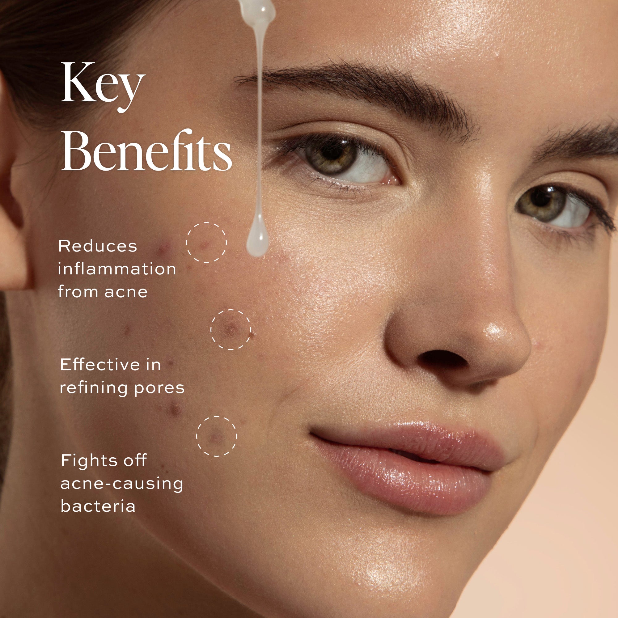 Best Acne Toning Serum for Clear Skin - Anti-Blemish Facial Treatment for Oily & Sensitive Skin - Perfect for Daily Skincare Routine & Post-Workout Care