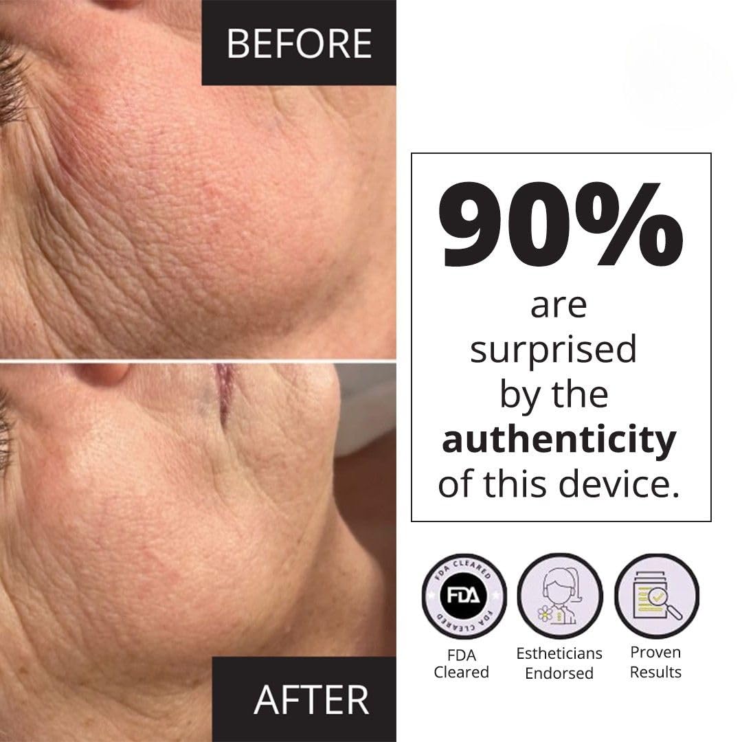 MyoLift Mini Microcurrent Facial Device - Non-Invasive Face Lift & Skin Tightening for Anti-Aging | 400 Microamp Power | Professional Esthetician Supplies & Skincare Tools | Perfect for At-Home Facial Treatments & Spa Days