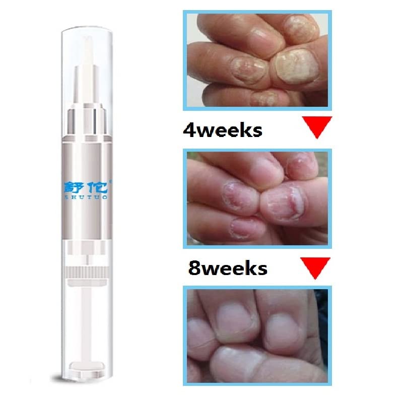 Herbal Nail Repair Pen - Nail Treatment for Stronger Fingernails & Toenails with Rich Nutrients (4 Pack) | Perfect for Damaged Nails, Manicures & Pedicures at Home
