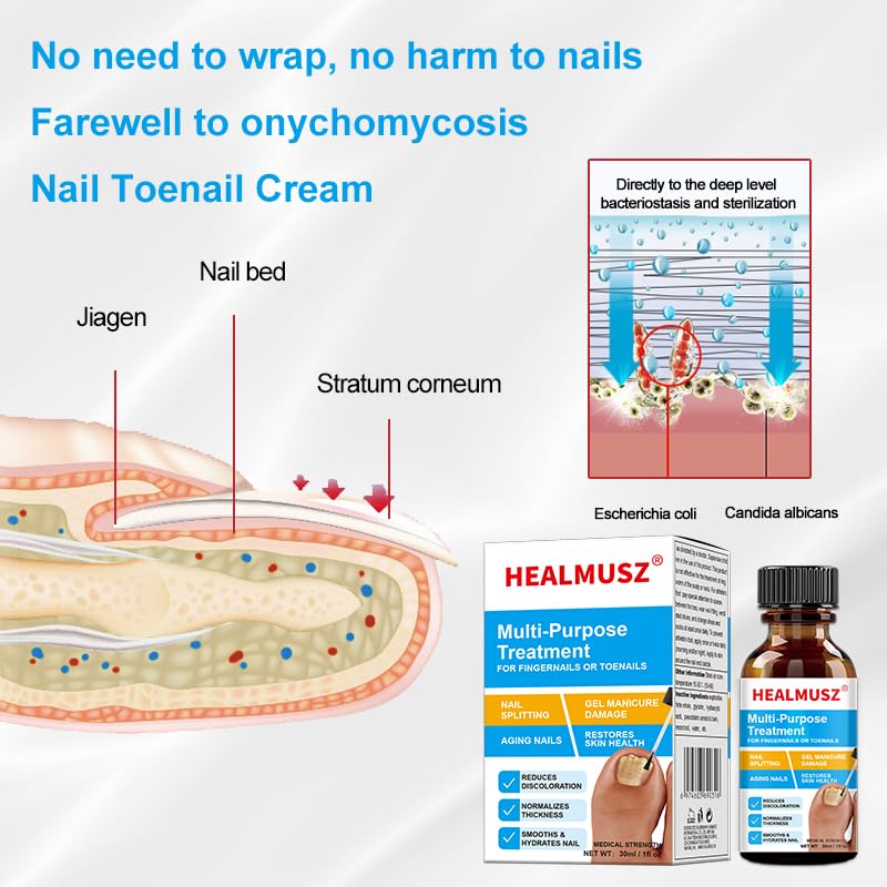 Extra Strength Toe Fungus Nail Treatment - Fast Acting Antifungal Solution with Tea Tree & Propolis for Healthy Nails | Lightweight Nail Care for Manicures & Pedicures | Ideal for Athletes, Swimmers & Daily Foot Care