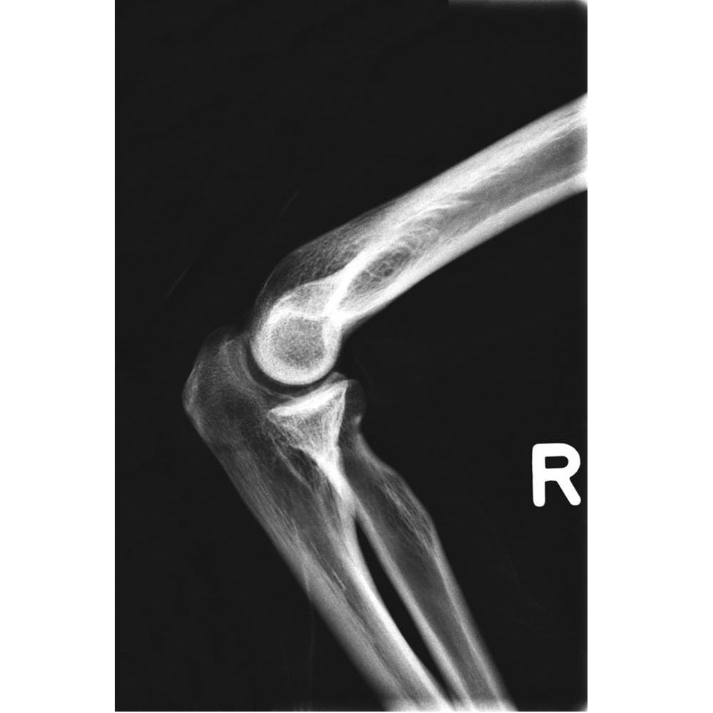 Full Body X-Ray Phantom with Real Human Skeleton Bones - High-Quality Medical Training Model for Radiology, Anatomy Studies & X-Ray Positioning Practice (Ideal for Medical Schools, Hospitals & Research Labs)