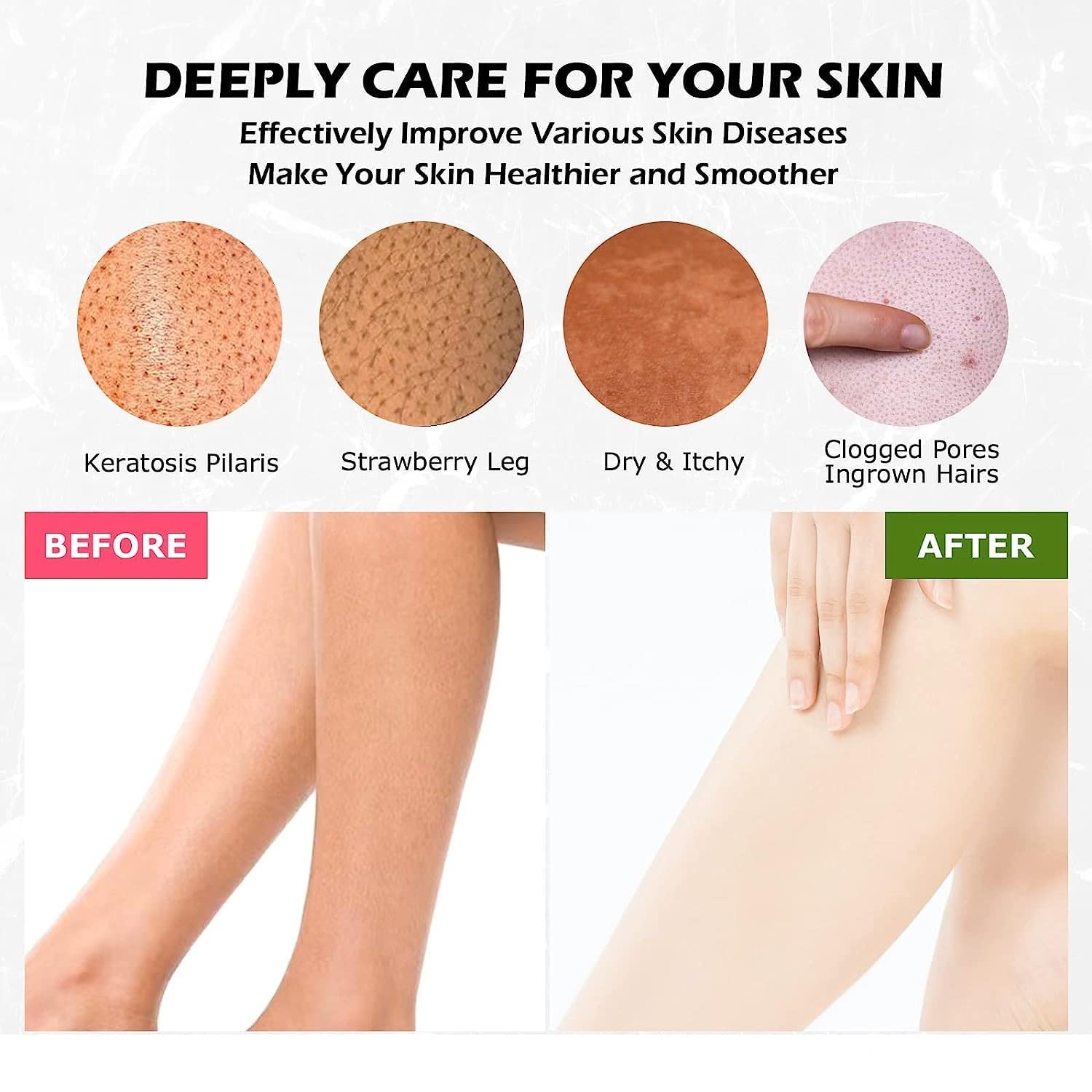 Premium Exfoliating Bath Gloves for Spa & Massage – Double-Layered Viscose Fiber Body Scrubber for Dead Skin Removal & Tan Removal – Face & Body Exfoliator with Thumb Design – Perfect for Home Spa, Self-Care Routine & Gift Giving