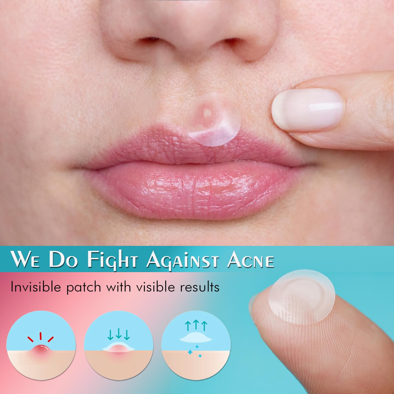 Acne Pimple Patches - Ultra Thin Hydrocolloid Blemish & Zit Covers for All Skin Types | 96 Count | Natural Healing Spot Treatment | Perfect for Overnight Use & Daily Breakout Care