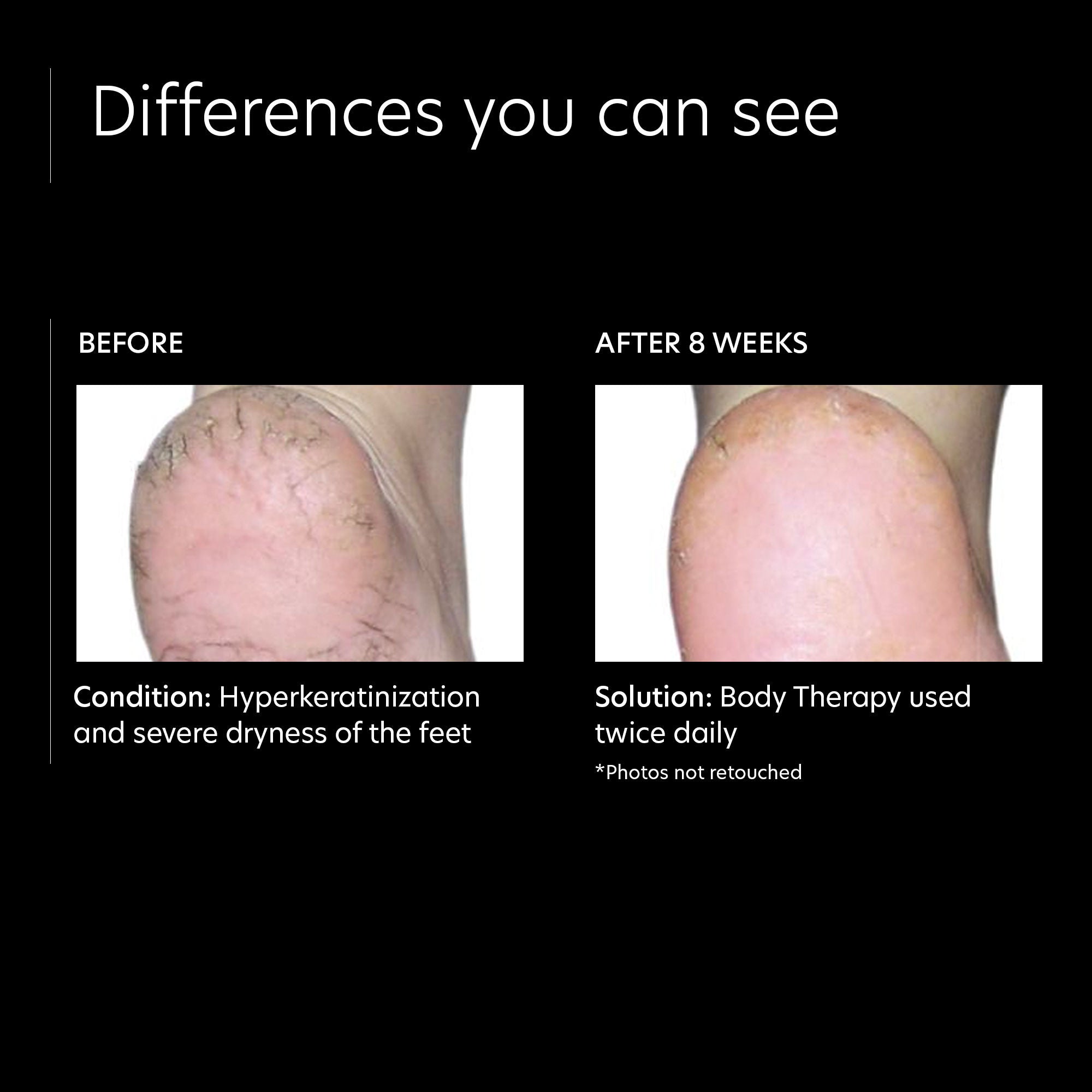 PCA Skin Body Therapy - Professional Skincare for Hydration & Rejuvenation - Perfect for Daily Use & Spa Treatments