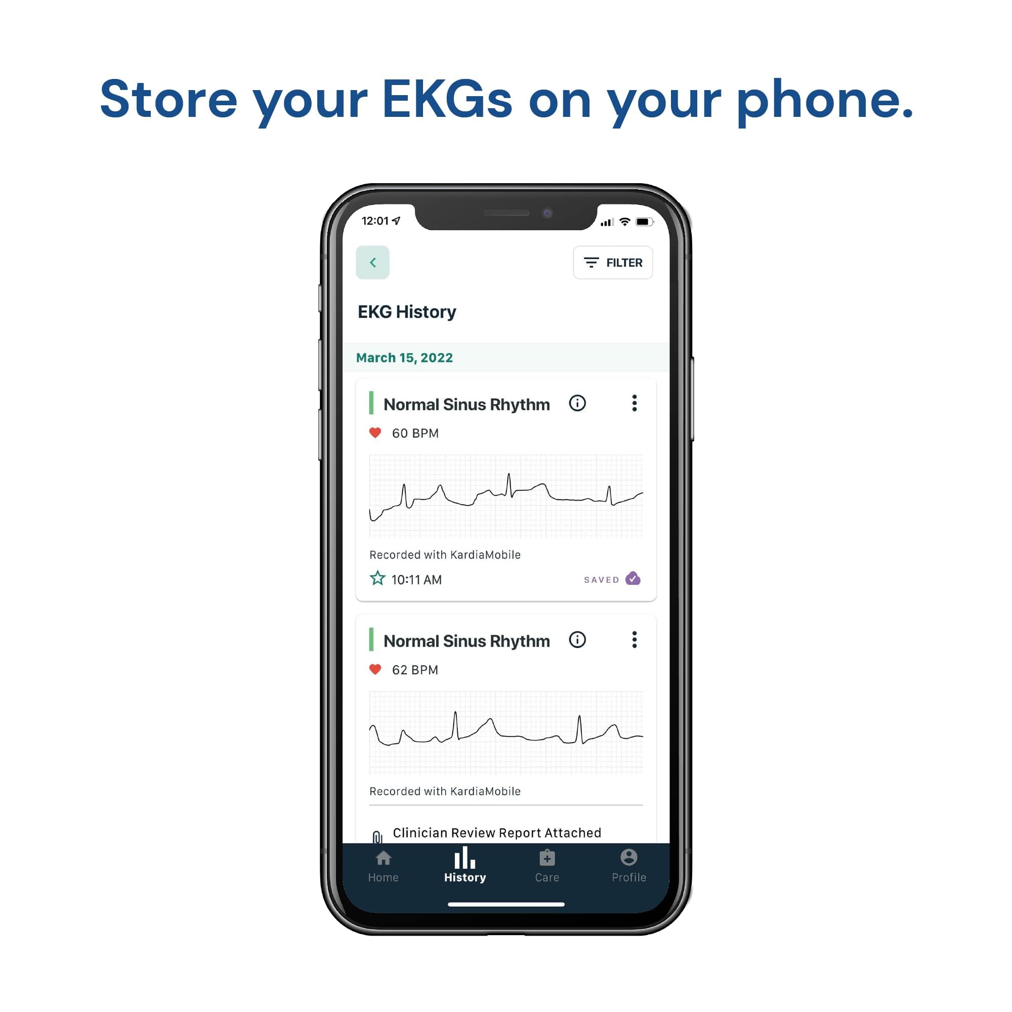 AliveCor KardiaMobile Wireless ECG Monitor - Portable EKG Device for Atrial Fibrillation Detection | Home Heart Health Monitoring | Perfect for Travel, Gym & Remote Cardiac Care