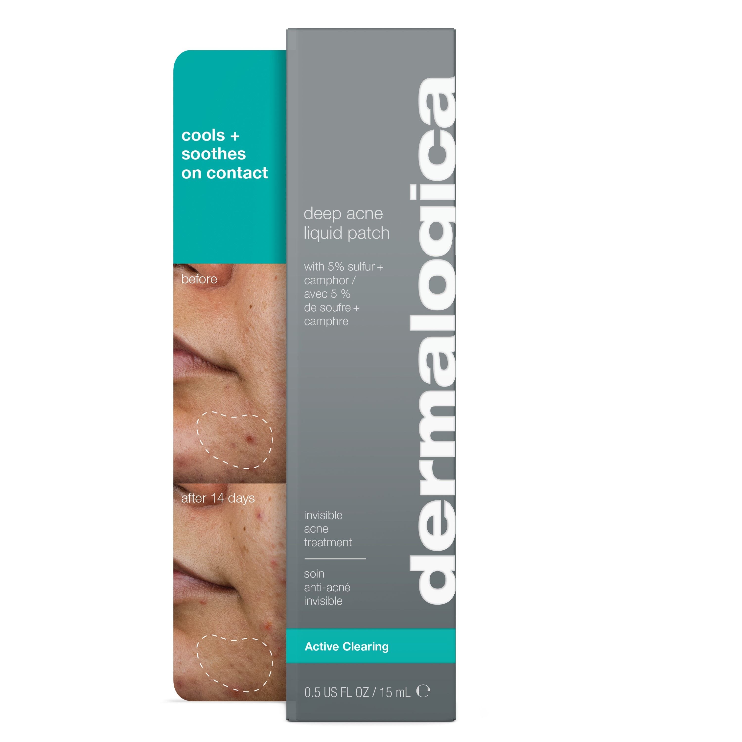Best Deep Acne Liquid Patch for Pimple Treatment - Fast Healing Acne Spot Cover for Face & Body - Perfect for Overnight Use & Daily Skincare Routine