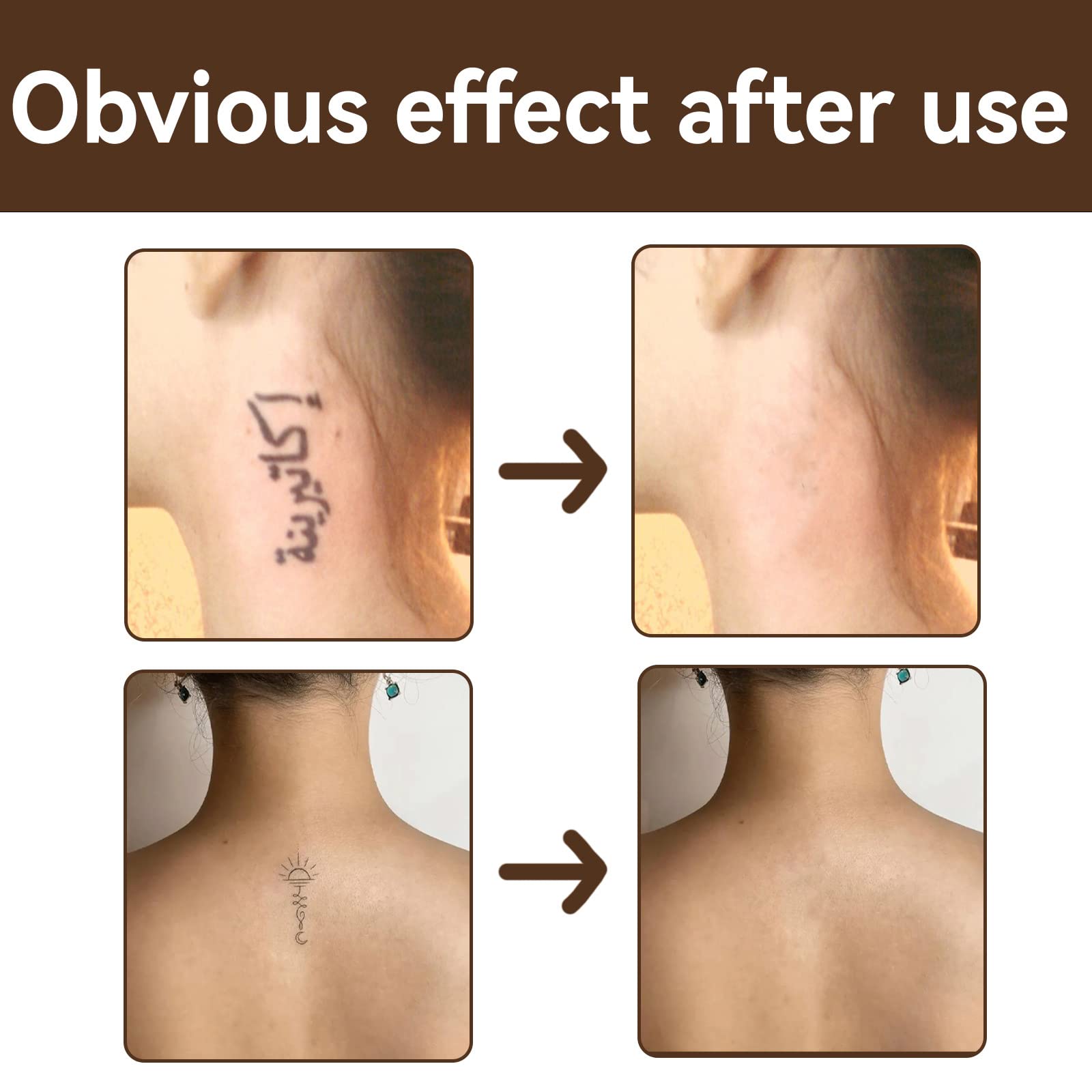Waterproof Tattoo & Scar Concealer Cream - Full Coverage Makeup for Dark Spots, Birthmarks & Imperfections | Men & Women | Daily Use, Special Events & Professional Makeup