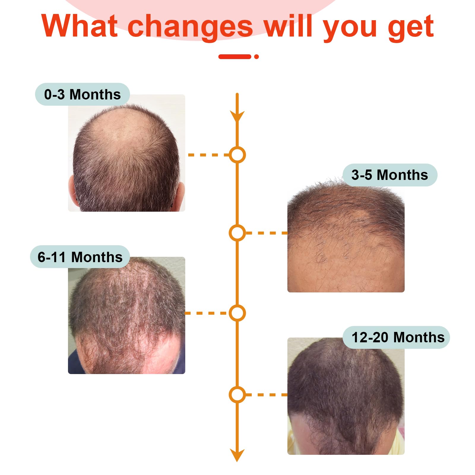 Laser Hair Growth Cap for Men & Women - FDA Cleared Hair Regrowth Treatment for Thinning Hair - At-Home Low Level Laser Therapy (LLLT) Device for Hair Loss Prevention & Scalp Stimulation - Perfect for Daily Use at Home or Office