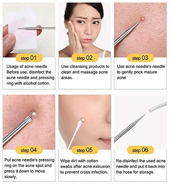 Professional Blackhead Remover Tool - Dual Head Stainless Steel Extractor for Pimples, Milia & Pus Removal (Round & Pointed Tips, Pack of 2) - Perfect for Facial Care & Acne Treatment at Home