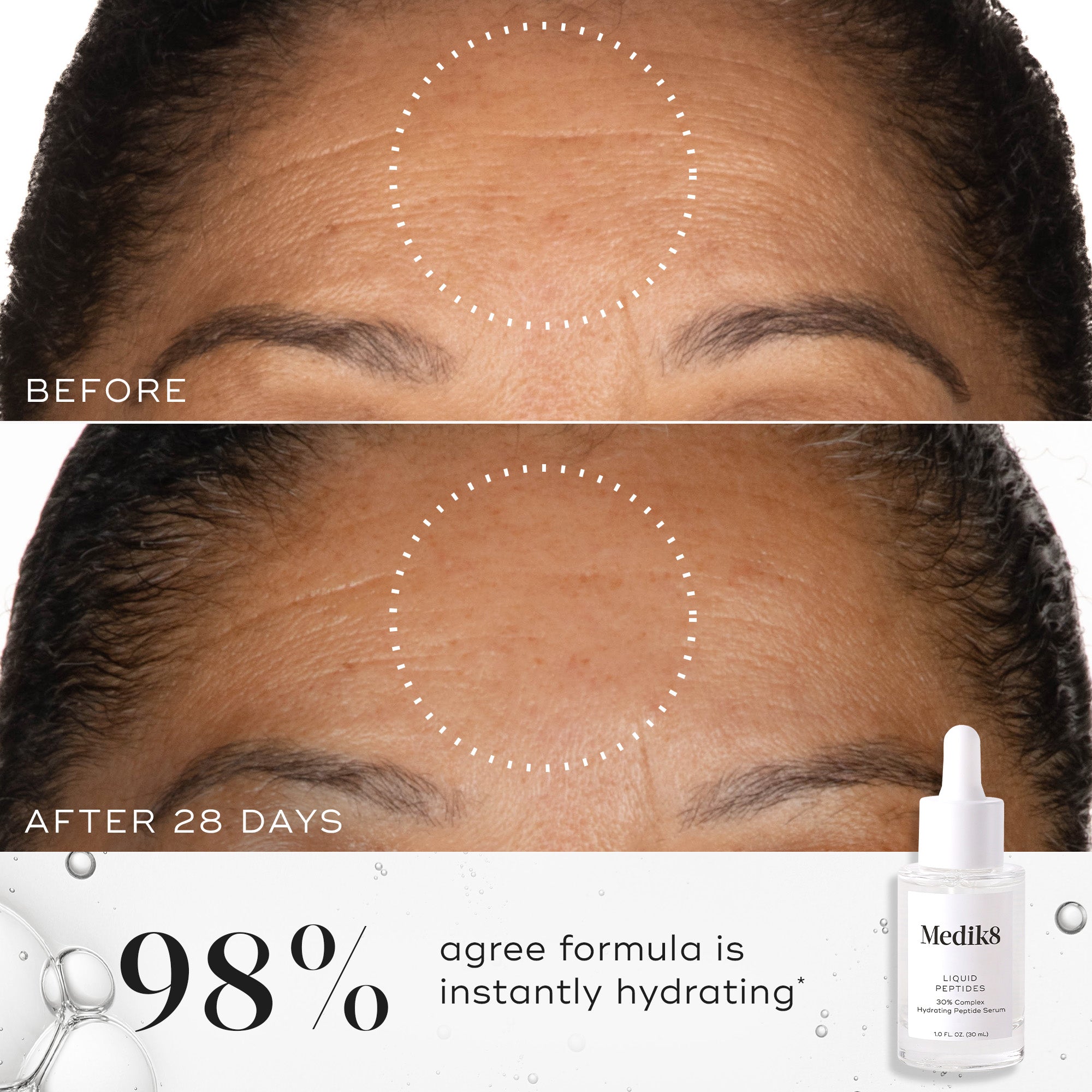 Liquid Peptides™ - Premium Collagen Peptides for Skin & Joint Health | Anti-Aging Supplement | Supports Hair & Nail Growth | Perfect for Smoothies, Coffee & Post-Workout Recovery