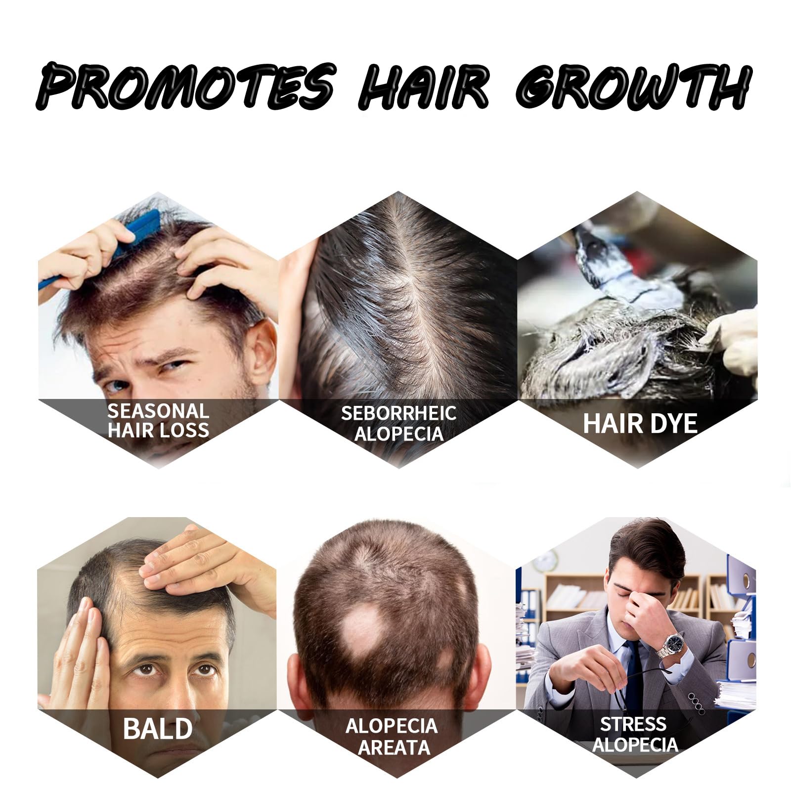 2Pcs Hair Growth Spray for Thinning Hair - Natural Rice Water Hair Treatment for Men & Women (50ml) | Promotes Healthy Hair Growth, Strengthens Follicles | Perfect for Daily Hair Care Routine & Scalp Nourishment
