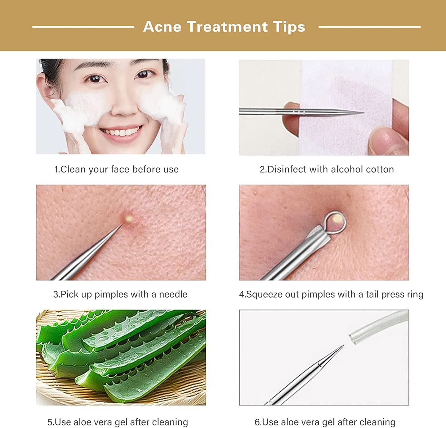SWEETPEA Acne Extractor Kit - Professional Blackhead Tweezers & Pimple Popper Tool for Ingrown Hair & Facial Impurities Removal - Perfect for Home Skincare & Spa Treatments