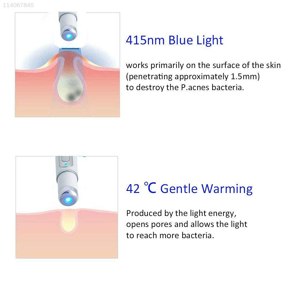 Ubersweet® 0355 White Beauty Instrument Pen - Facial Skin Care Device for Wrinkles & Fine Lines | Portable & Rechargeable | Perfect for Home & Travel Use