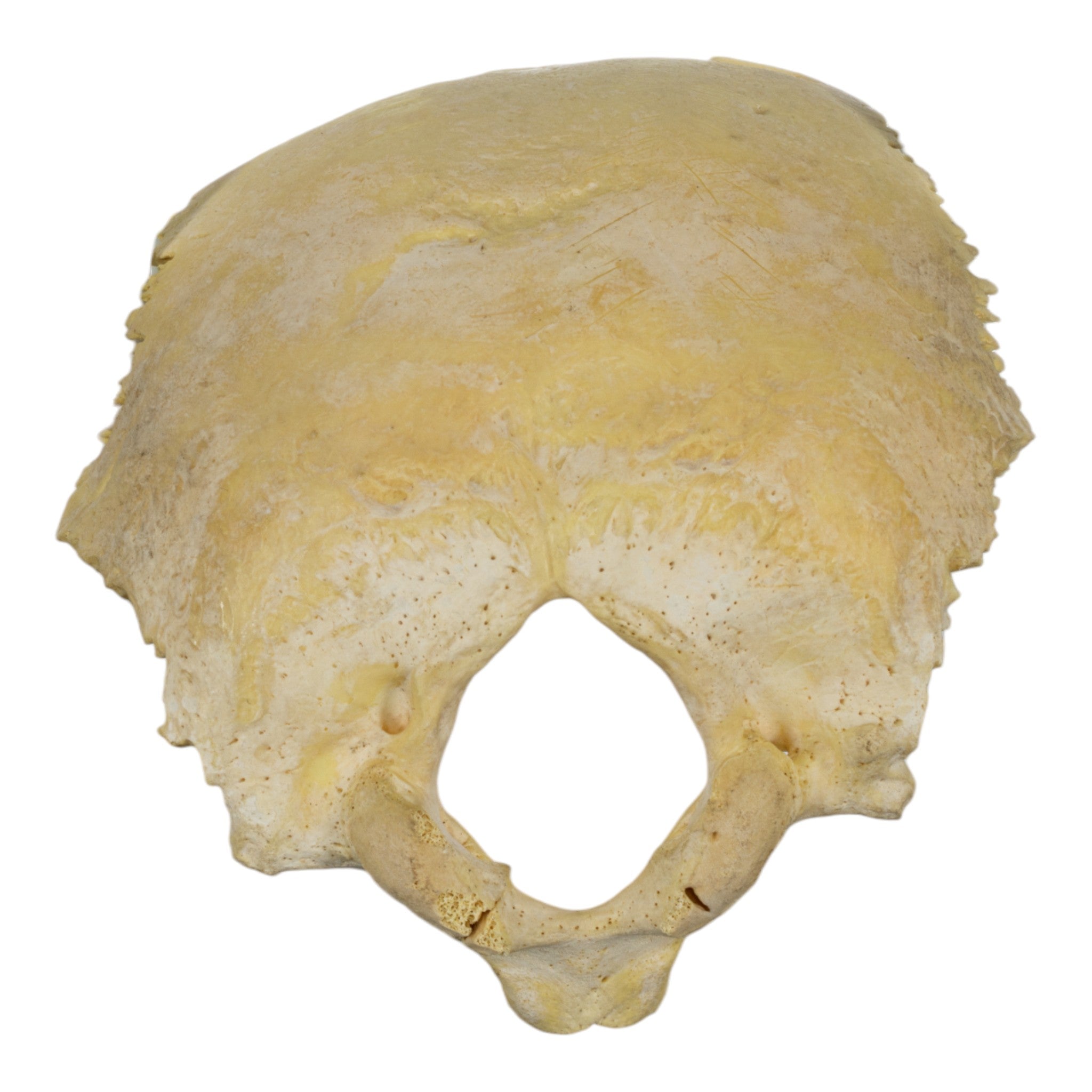 Authentic Human Child Occipital Bone Specimen - Medical Education, Anatomy Study & Forensic Science Training