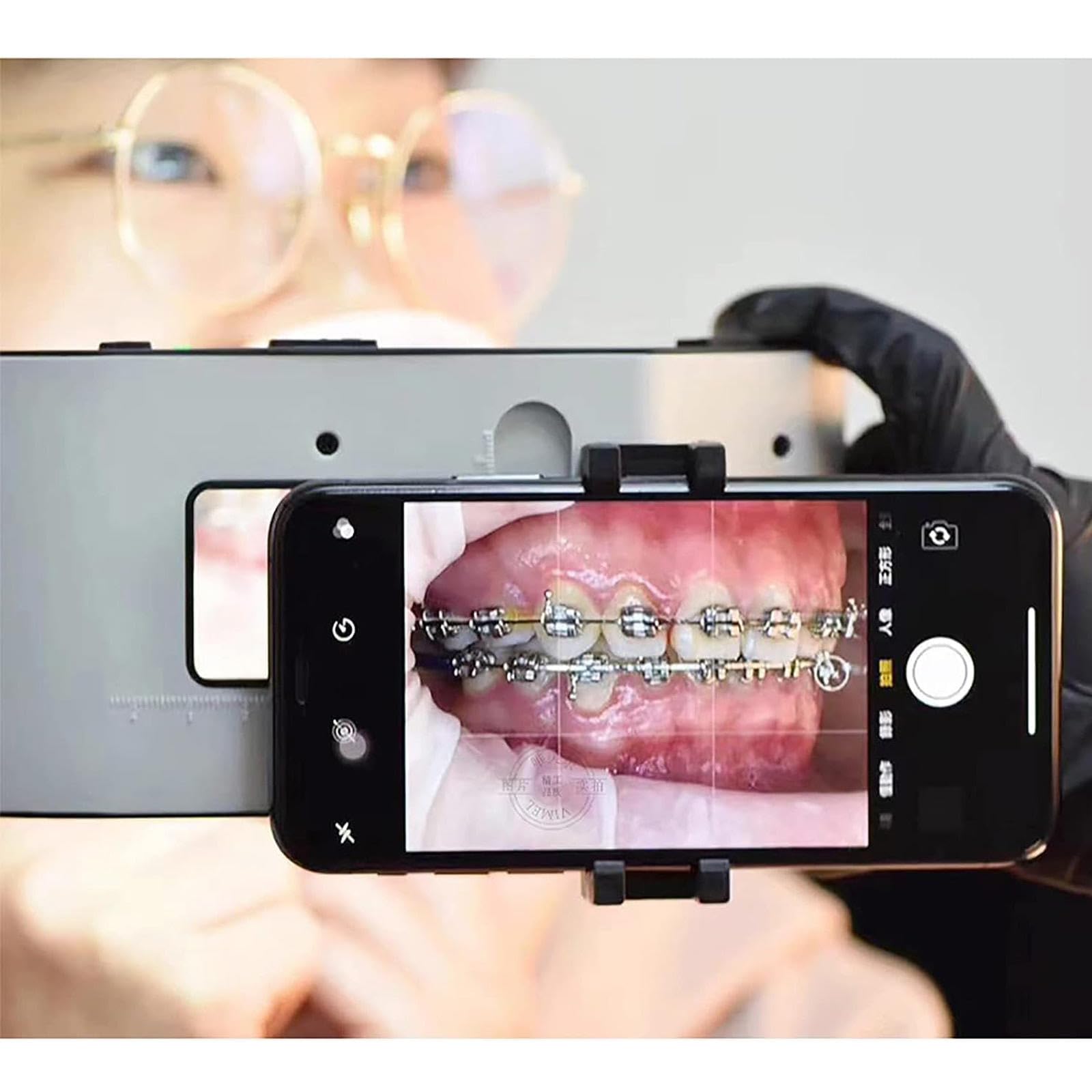 Dental Photography Aid - 20 LED Oral Camera Fill Light with Adjustable Brightness for Dentists, Home & Salon Use | Perfect for Teeth Whitening, Dental Exams & Oral Hygiene Documentation
