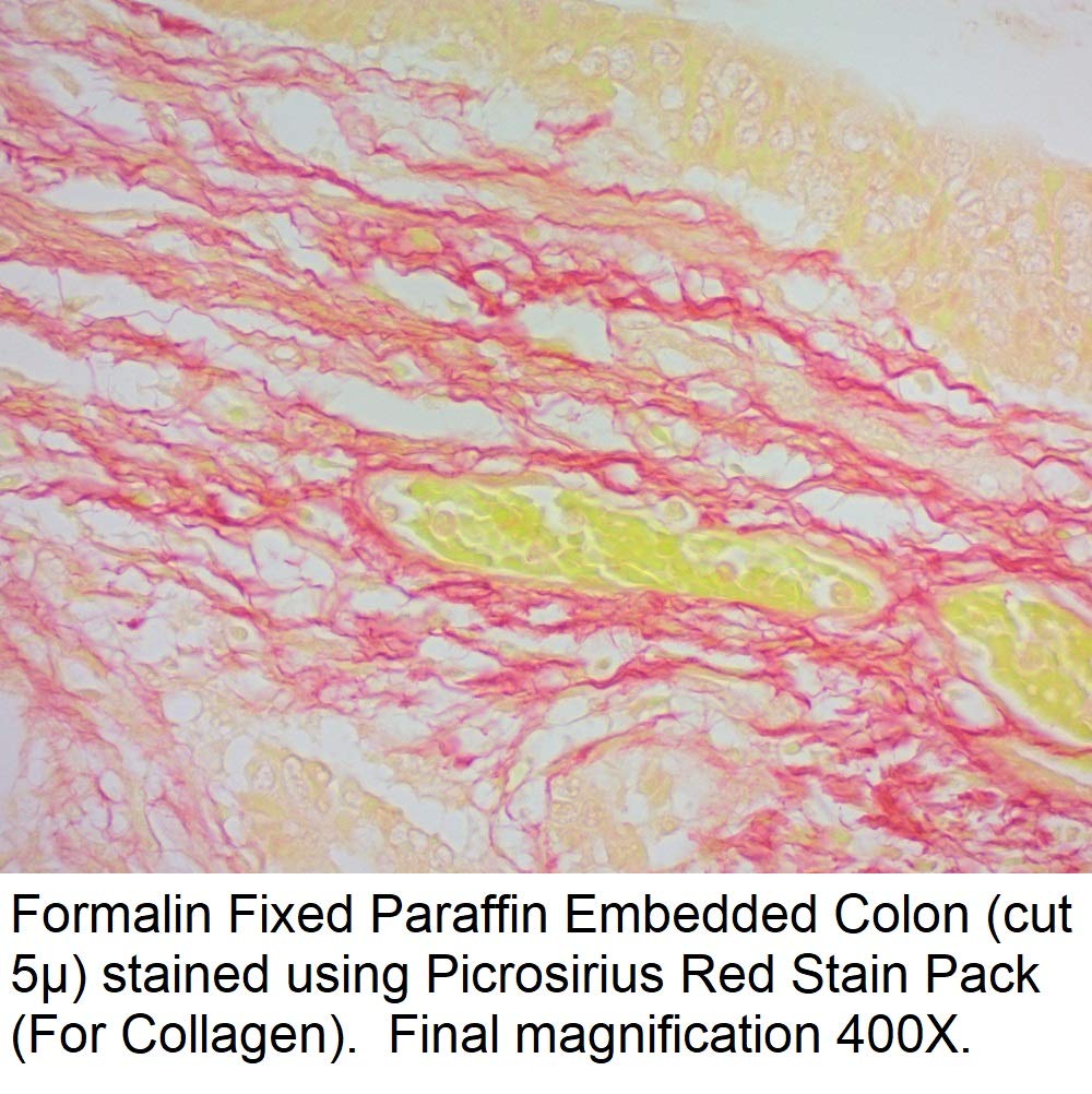 Picrosirius Red Stain Solution 1000ml - High-Quality Collagen Staining for Histology & Pathology Labs