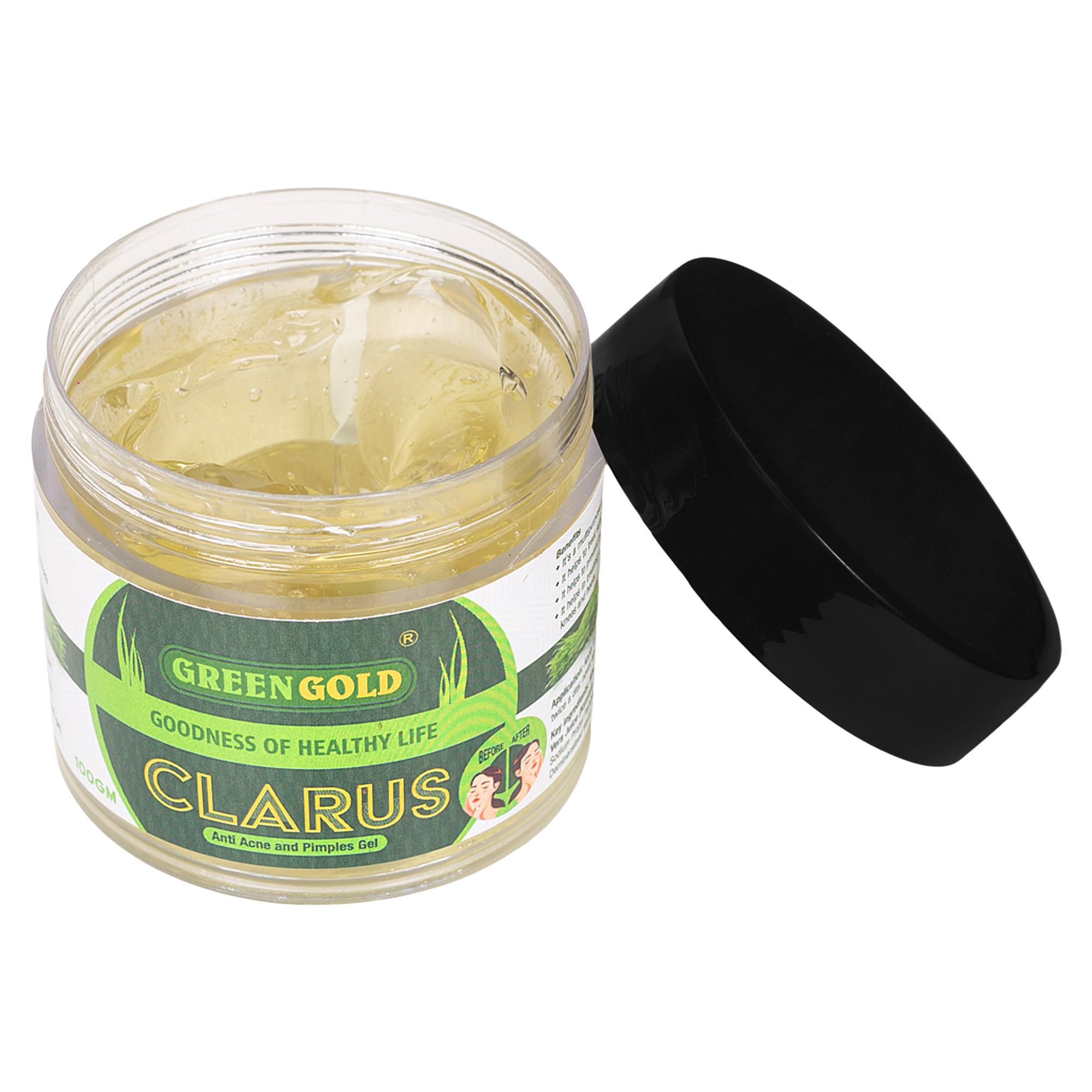 GreenGold Clarus Gel - Acne & Scar Treatment for Clear Skin | Hydrating Anti-Aging Face Gel with Glowing Formula | 100g | Perfect for Daily Skincare Routine & Post-Acne Care