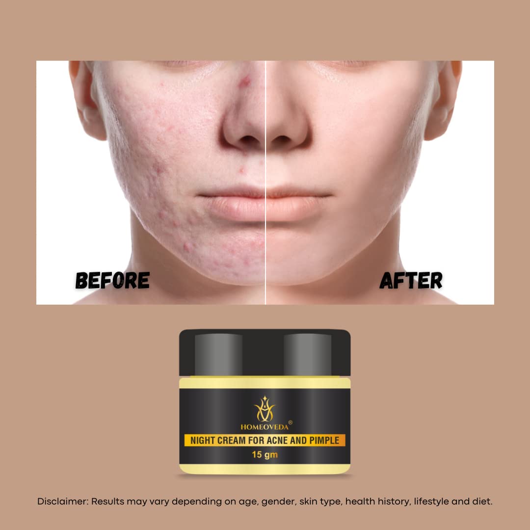 Homeoveda Handmade Acne & Pimple Removal Cream - Treats Acne Scars, Dark Spots & Blemishes with Saffron & Aloe Vera - 15g | Clear Skin Solution for Daily Face Care & Acne Treatment