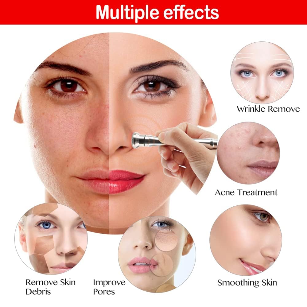 Professional Diamond Microdermabrasion Machine for Face - 65-68cmHg Suction Power, At-Home Facial Care & Skin Exfoliation Tool - Perfect for Anti-Aging, Blackhead Removal & Glowing Skin