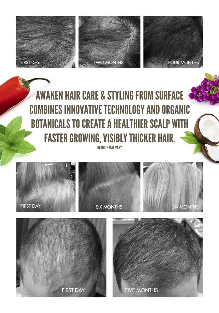 Surface Hair Awaken Therapeutic Conditioner for Damaged Hair - Repairing & Nourishing Treatment for Dry, Frizzy Hair - Salon-Quality Deep Conditioning at Home (Perfect for Post-Color, Heat Styling & Chemical Treatments)