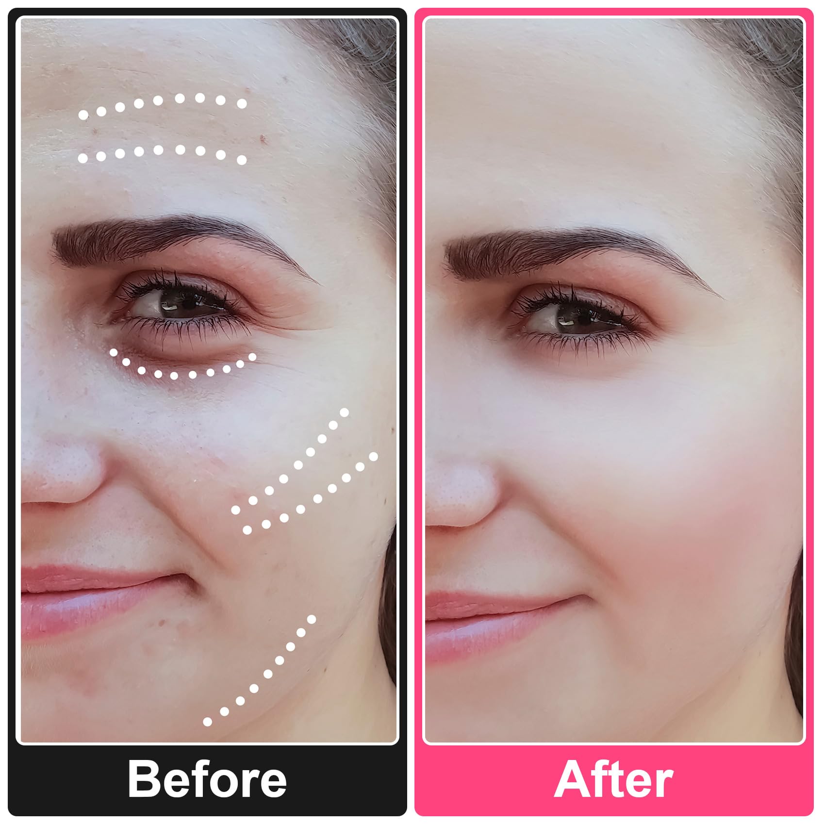 ANCIRS 40 Pcs Invisible Face Lift Tape - Instant Neck & Facelift Tape for Sagging Skin, Double Chin & Eye Wrinkles | Reusable Adhesive Tape for Instant Tightening, Special Occasions & Daily Beauty Routine
