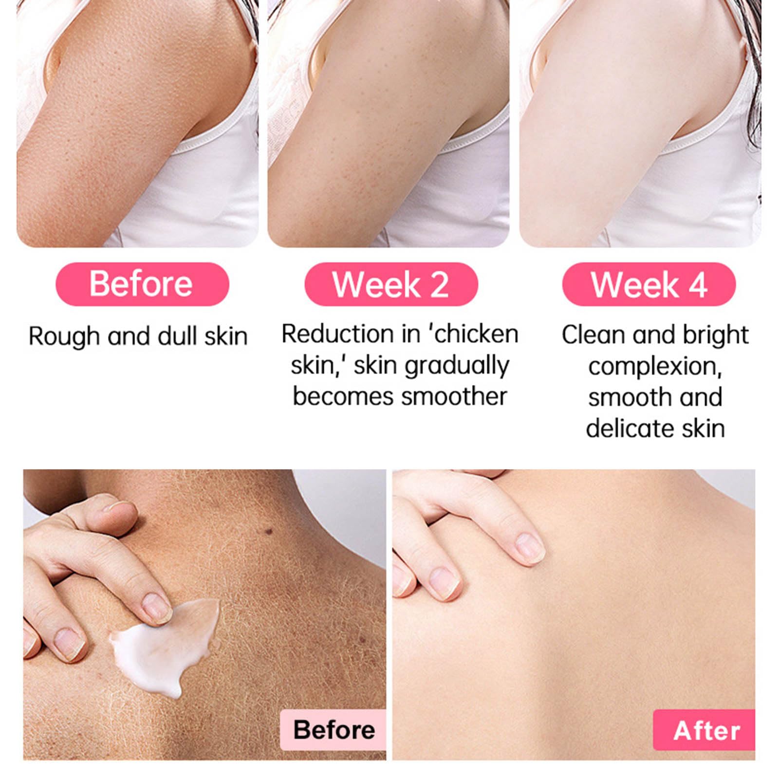 Exfoliating Body Scrub for Strawberry Legs & Keratosis Pilaris - Bump Eraser Treatment for Women, Smoothing Cream for Rough Bumpy Skin - Perfect for Daily Body Care & Post-Shave Use