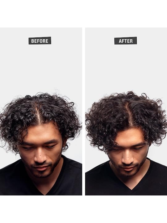 Royal Remedy Anti-Hair Fall Charcoal Shampoo - Black & Energy Formula for Dandruff Control, Hair Loss Treatment & Faster Growth with Plant Keratin | 200ml for Men & Women | Daily Use for Stronger, Healthier Hair at Home & Salon