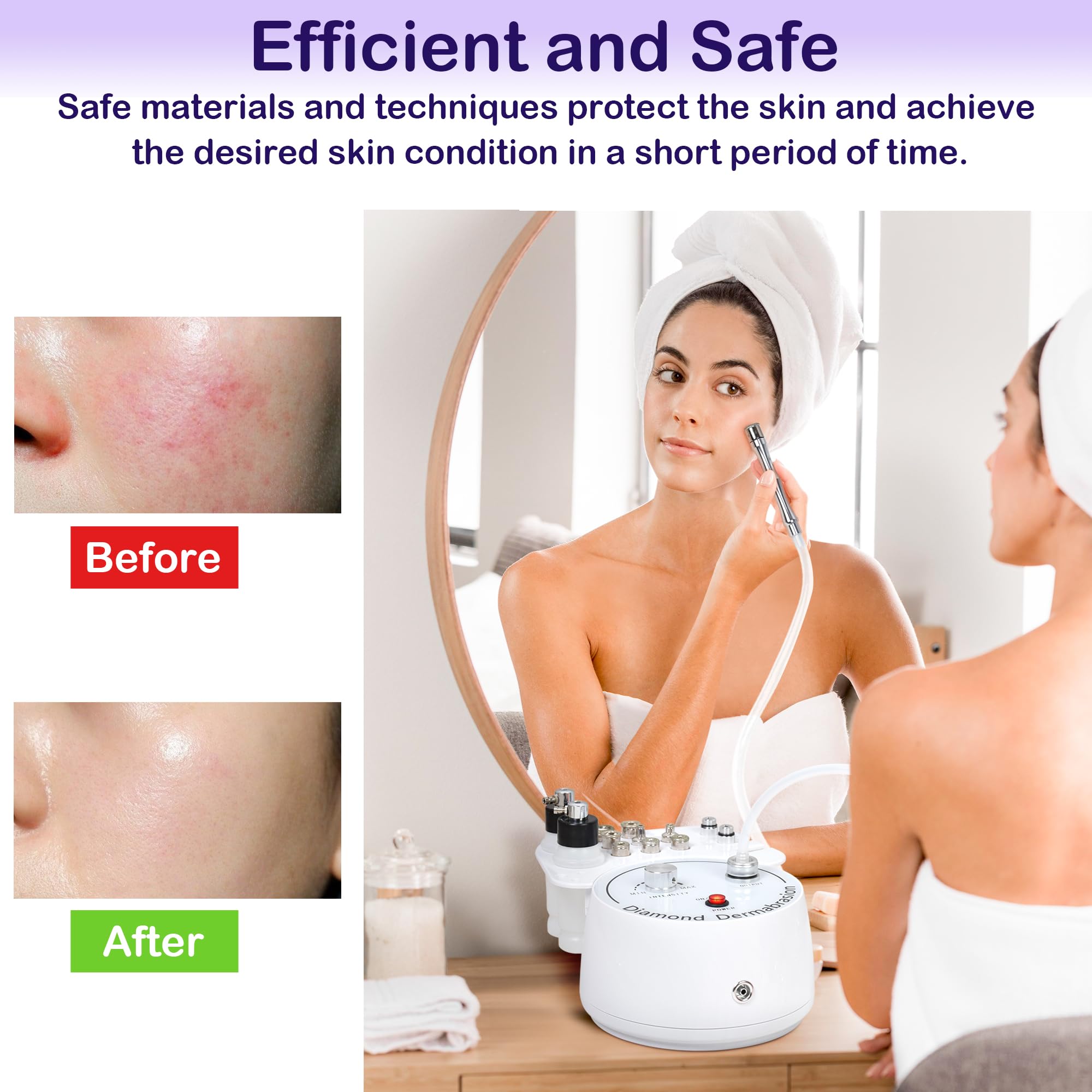 Professional 3-in-1 Diamond Microdermabrasion Machine for Face - Dermabrasion, Blackhead Removal & Hydration Spray | Esthetician & At-Home Skincare Device | Perfect for Spa Treatments & Facial Rejuvenation