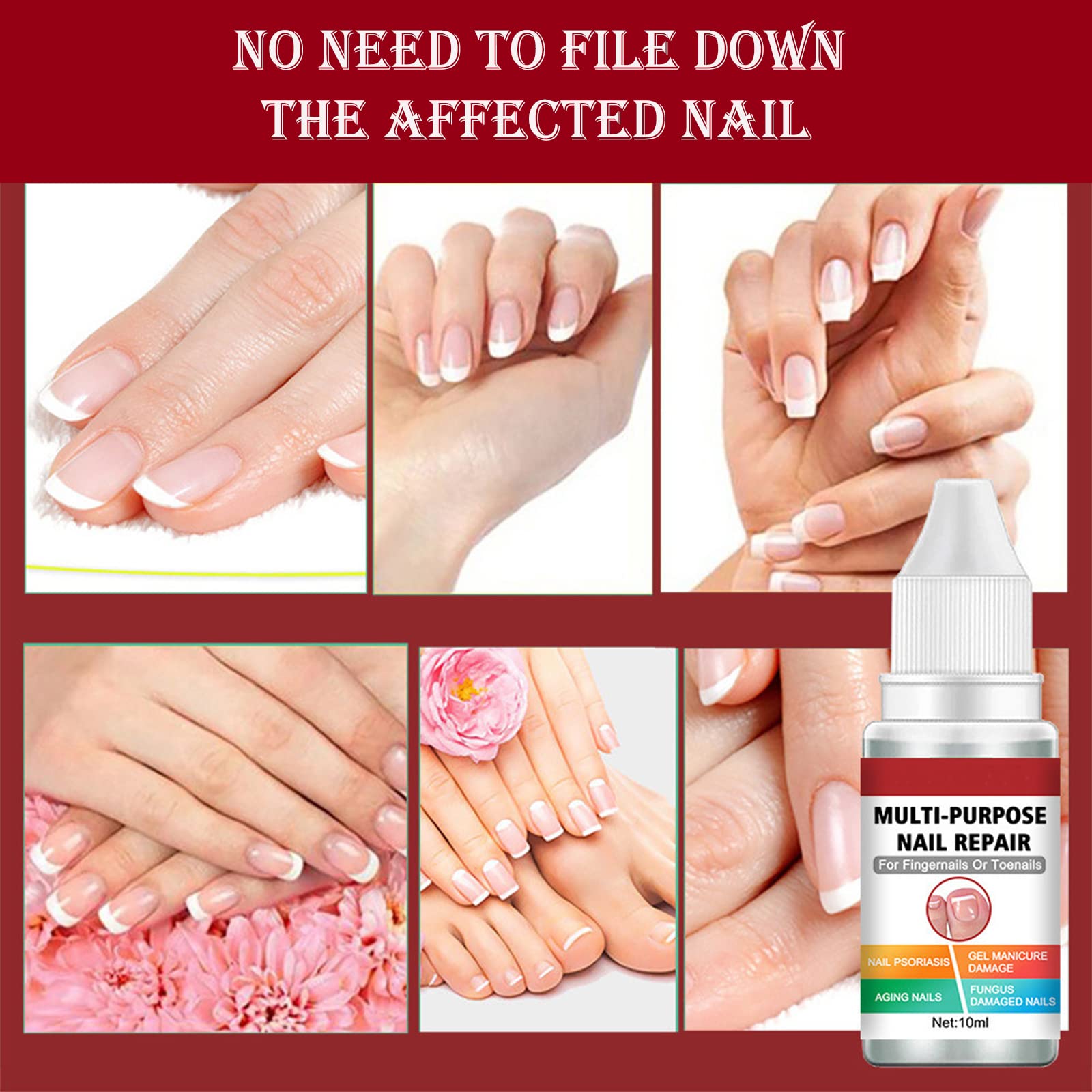 Extra Strong Fungal Nail Treatment for Toenails & Fingernails | Safe & Effective Nail Repair Lotion | Fixes Discolored & Damaged Nails | Multi-Purpose Antifungal Solution (10ML, Red) | Perfect for Athletes, Swimmers & Daily Foot Care