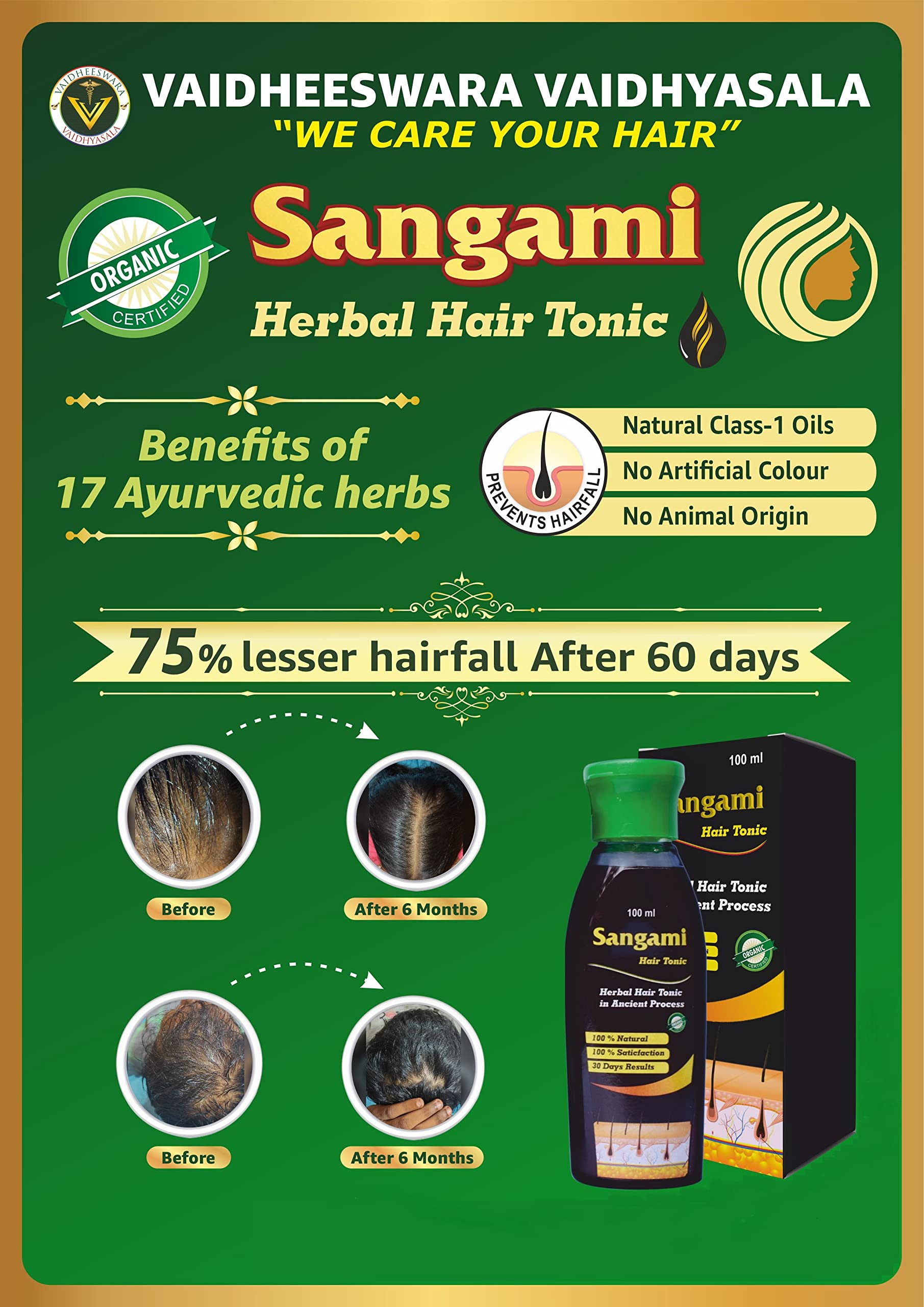 Sangami Hair Tonic for Hair Growth - Natural Hair Loss Treatment & Scalp Care - Promotes Thicker, Healthier Hair for Men & Women - Perfect for Daily Use & Styling