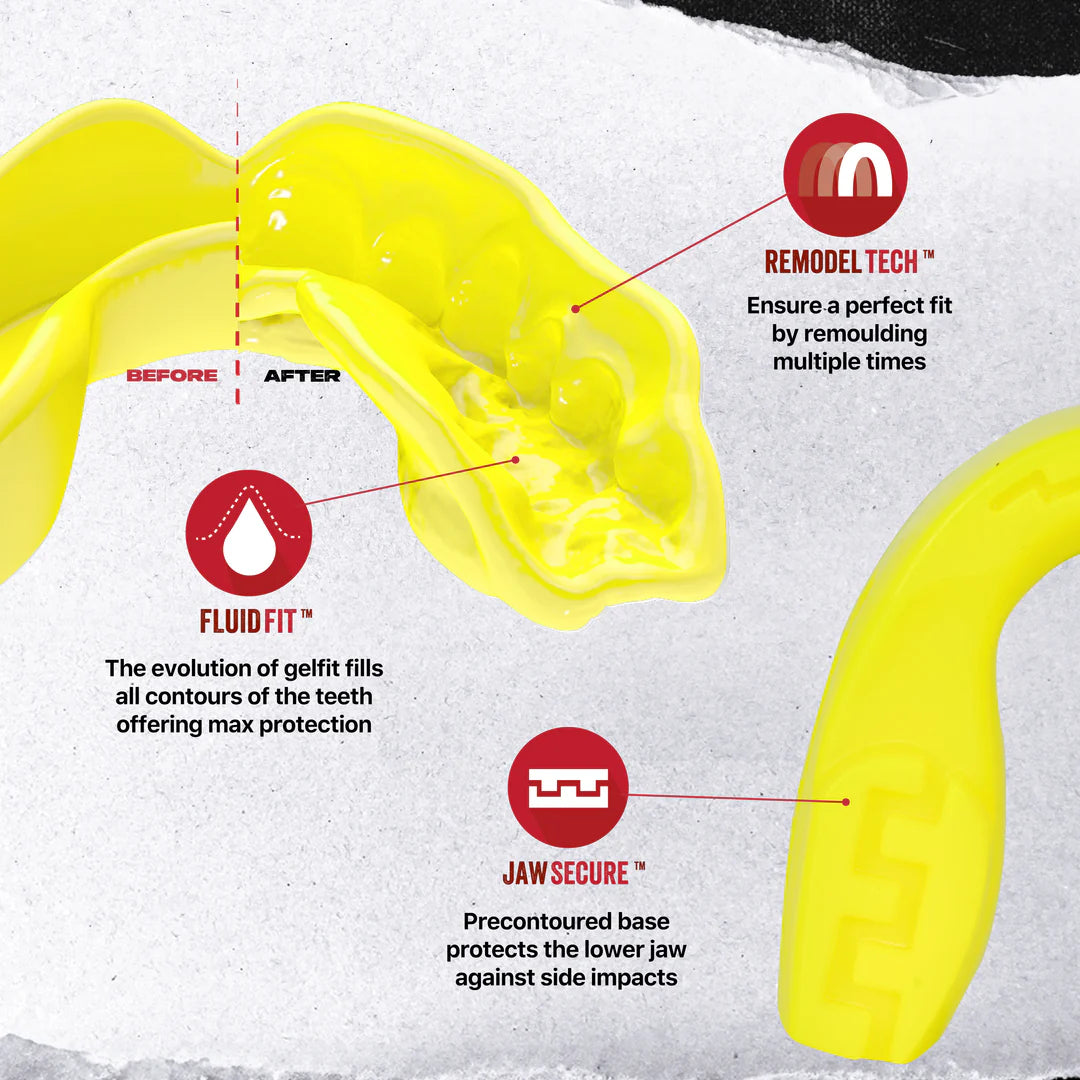 SafeJawz Intro Series Fluro Yellow - Durable & Comfortable Mouthguard for Sports, MMA, Boxing & Martial Arts - Perfect for Training & Competition Protection