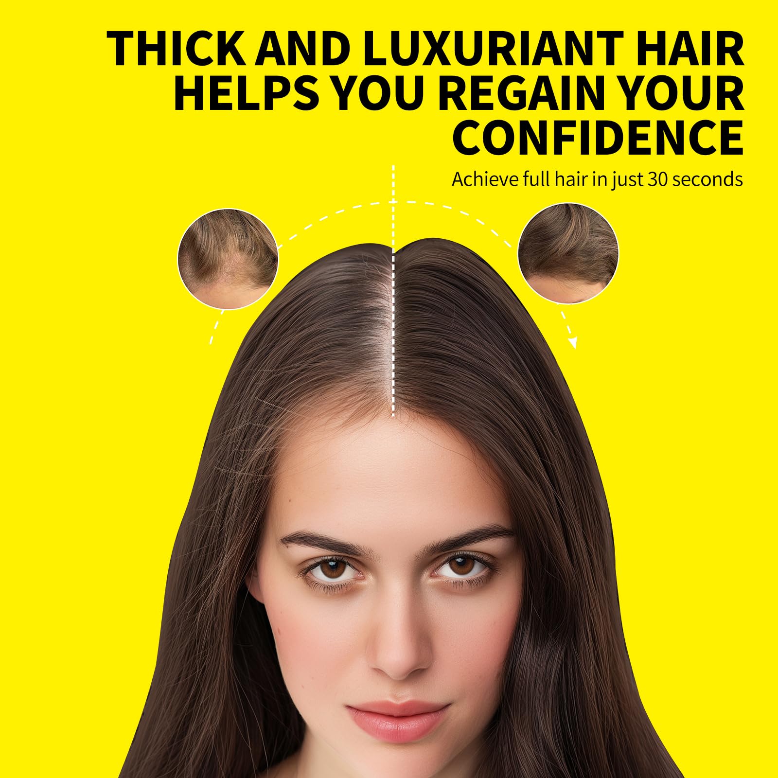 SEVICH Hair Building Fibers for Thinning Hair - Instant Thicker & Fuller Look - Natural Hair Powder for Men & Women - 25g Black - Perfect for Daily Use, Special Occasions & Confidence Boosting