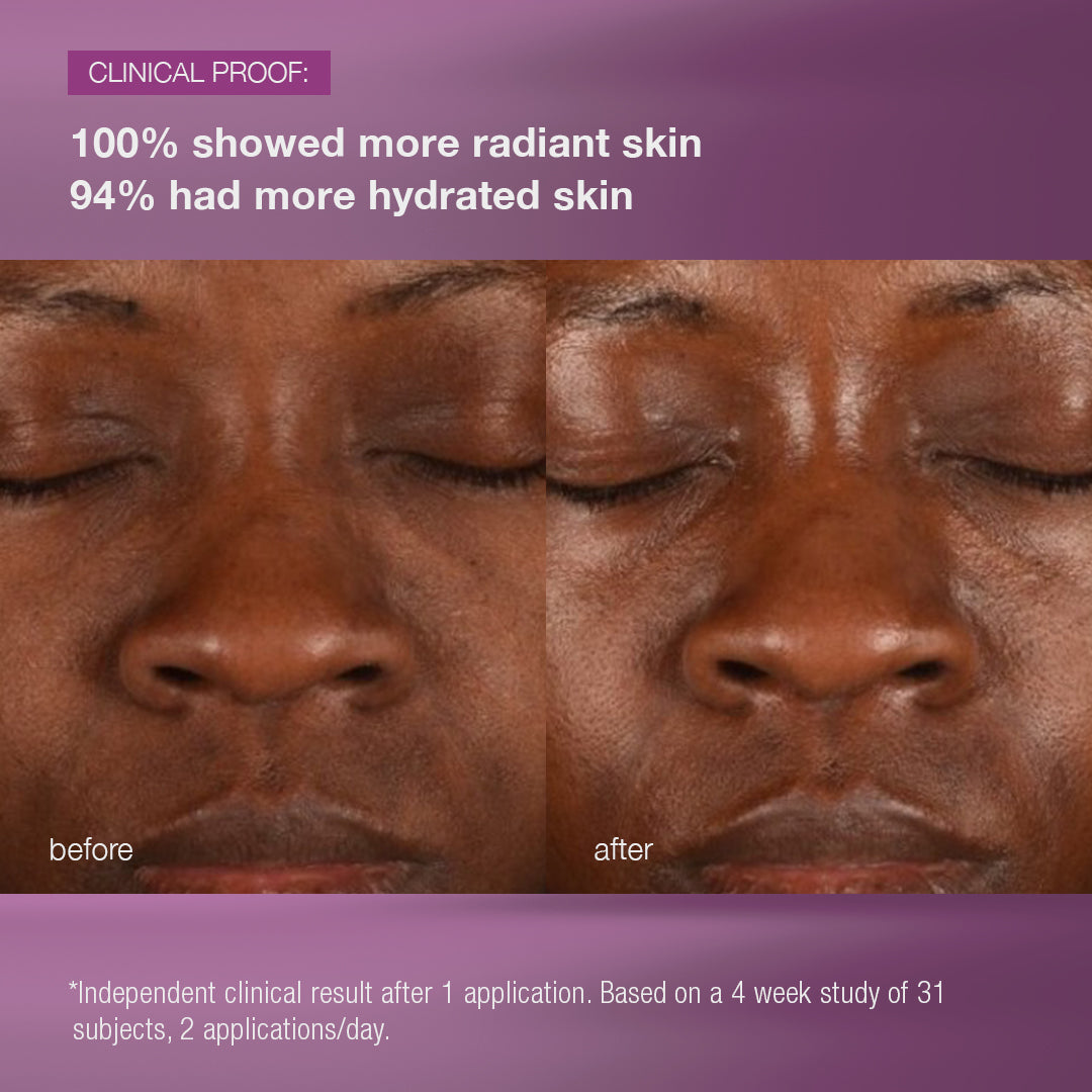 Best Multivitamin Power Recovery Cream for Skin Repair & Hydration - Ideal for Post-Workout, Dry Skin & Night Care