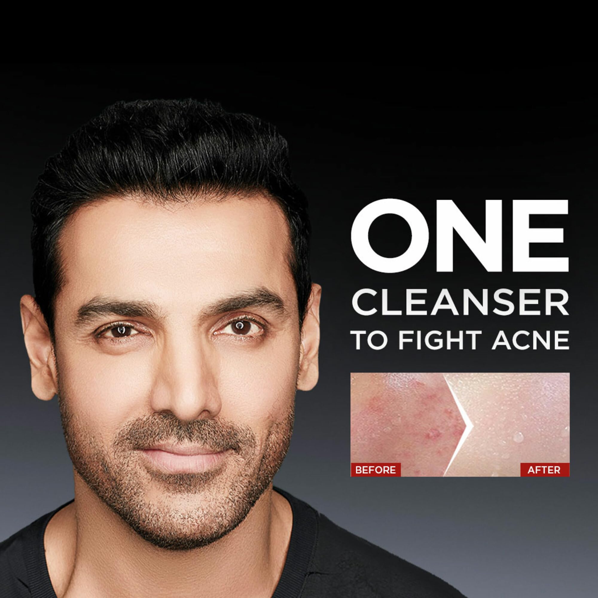 Garnier Men Acno Fight Anti Pimple Face Wash with Salicylic Acid & Herba Repair - 150g Oil-Free Cleanser for Acne-Prone Skin | Daily Skincare Routine for Men, Prevents Breakouts & Soothes Irritation