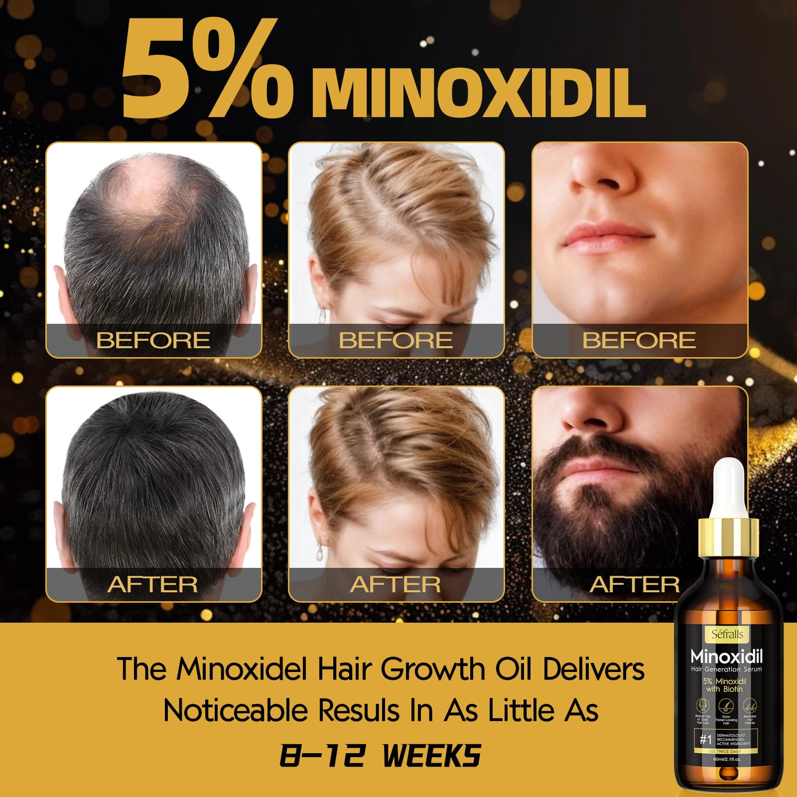 2-Pack 5% Minoxidil Hair Growth Serum for Men & Women - Hair Regrowth Treatment for Stronger, Thicker, Longer Hair - Beard & Facial Hair Growth Solution - Best for Hair Loss Prevention & Thinning Hair Care at Home