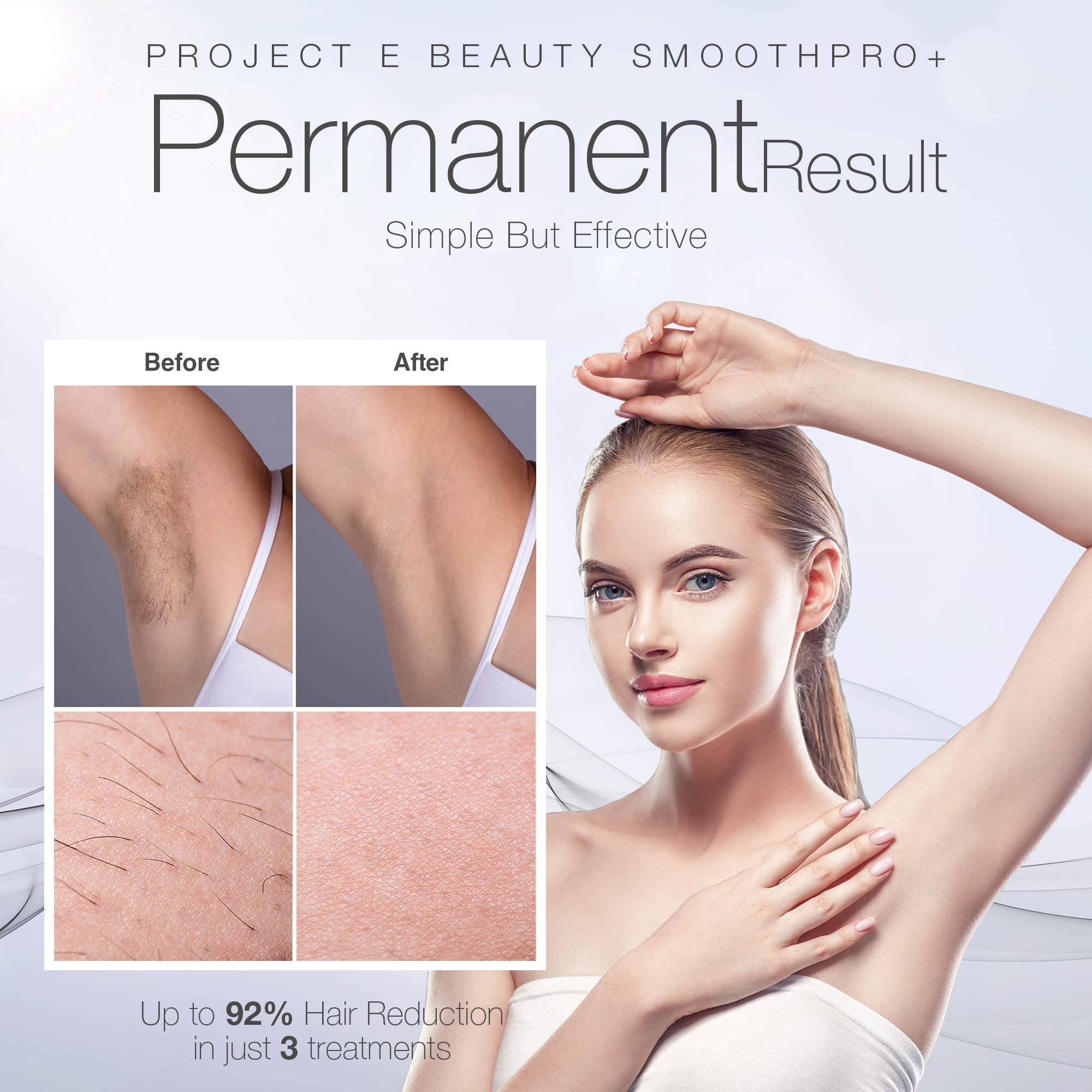 Project E Beauty SmoothPro+ IPL Hair Removal Device - Permanent Hair Reduction for Face, Armpits, Legs & Body | 5 Energy Levels, 300,000 Flashes | Painless & Long-Lasting | Perfect for Home Use, Travel & Salon-Quality Results