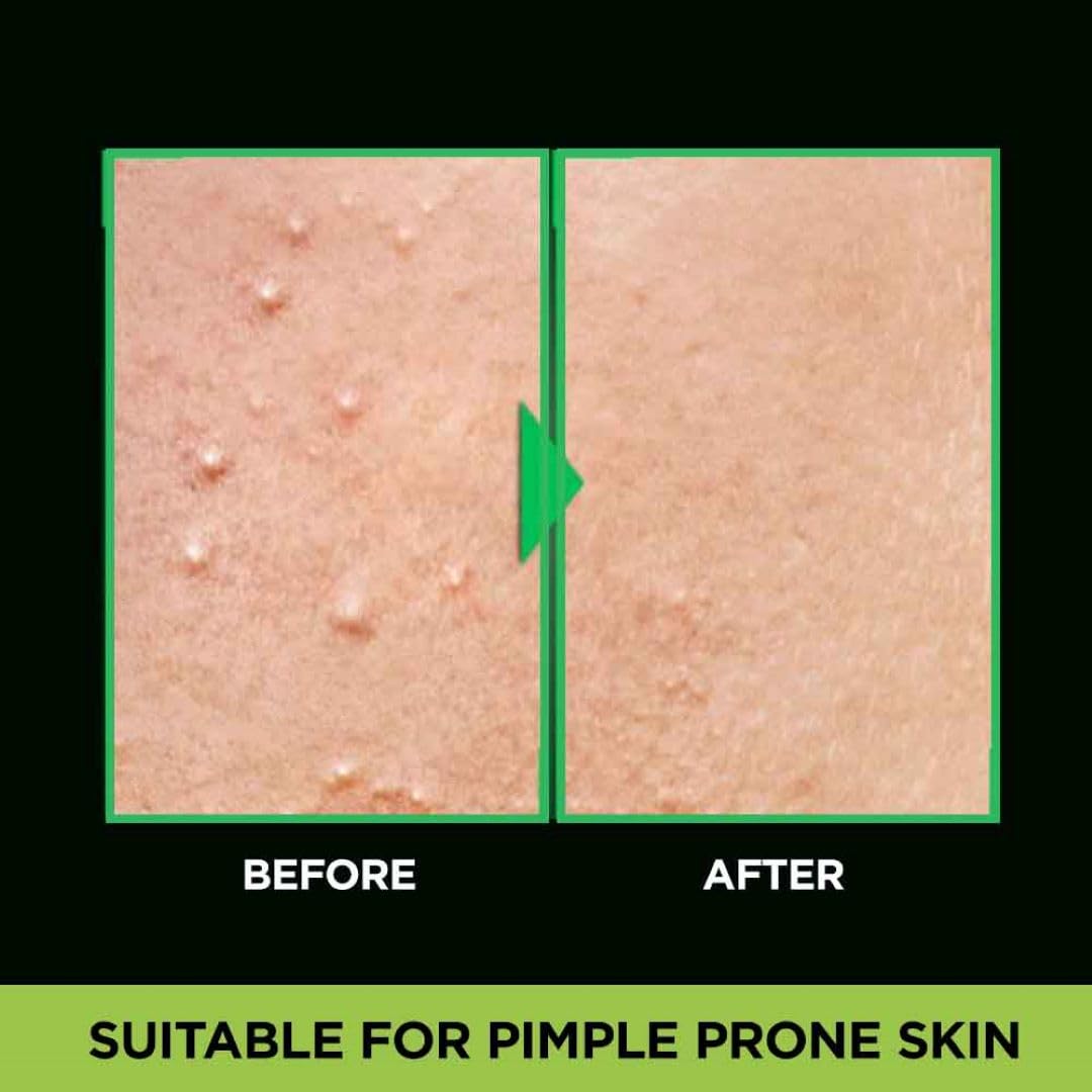 Garnier Men Acno Fight Anti Pimple Face Wash with Salicylic Acid & Herba Repair - 150g Oil-Free Cleanser for Acne-Prone Skin | Daily Use for Clear, Healthy Skin at Home or Gym