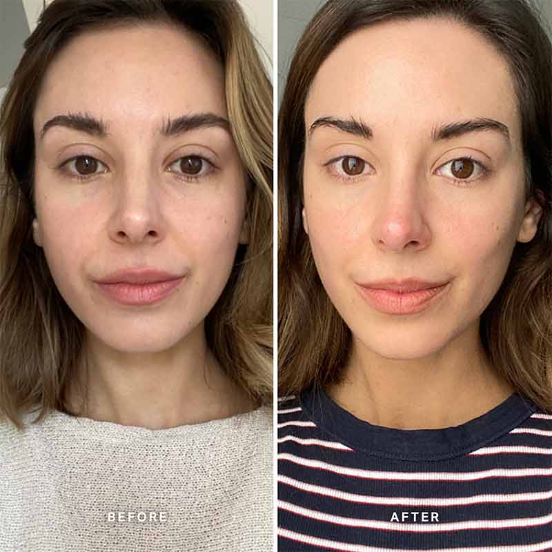 Alpha H Vitamin C Serum with 10% Ethyl Ascorbic Acid - Brightening & Anti-Aging Face Serum for Dark Spots & Wrinkles - Perfect for Daily Skincare Routine & Nighttime Use